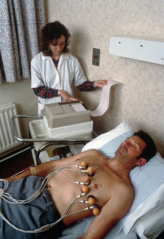 ECG